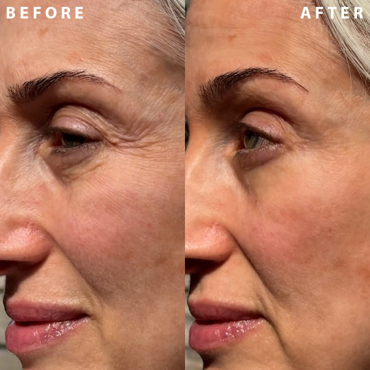 Wrinkle Fix