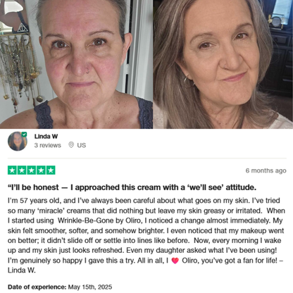 Wrinkles-be-Gone