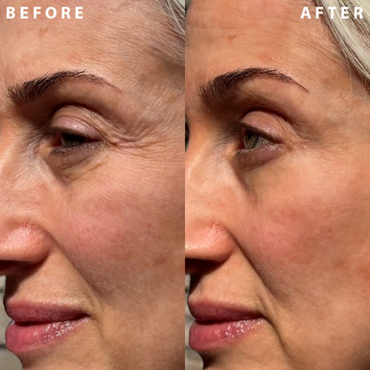 Wrinkle Fix